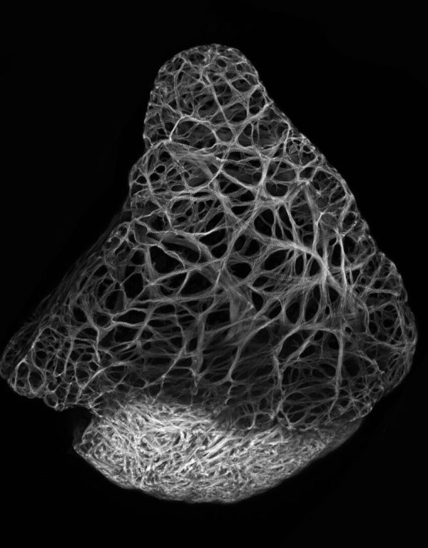 3wpf_myl7_LAeGFP_meis2bmutant